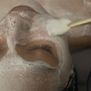 Luminous Botox Facial with Dermaplaning before and after Treatment | Luminous Skin Care Studio in Santa Clara, CA