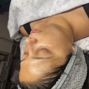 Dermaplaning Treatment going on | Luminous Skin Care Studio in Santa Clara, CA