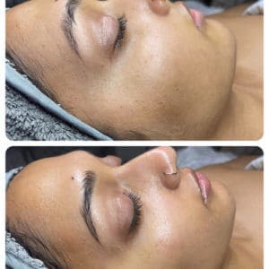 Luminous Signature Facial with Dermaplaning | Luminous Skin Care Studio in Santa Clara, CA