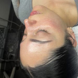 Hydrofacial | Luminous Skin Care Studio in Santa Clara, CA